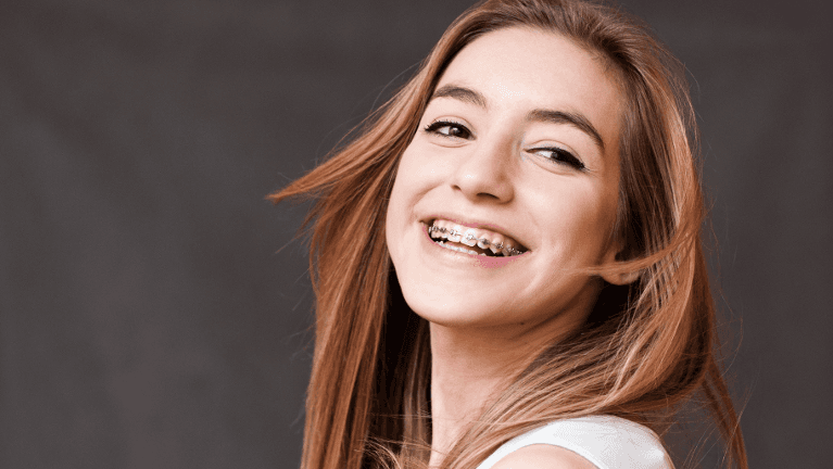 Kid laughing with braces on her teeth from Jerger Pediatric Dentistry