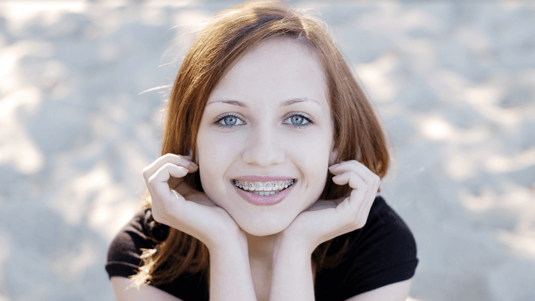 Child smiling after getting braces from Jerger Pediatric Dentistry